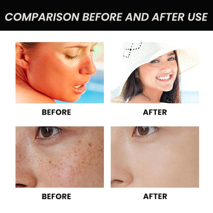 Relief Sun Rice Sunscreen For Face SPF50+