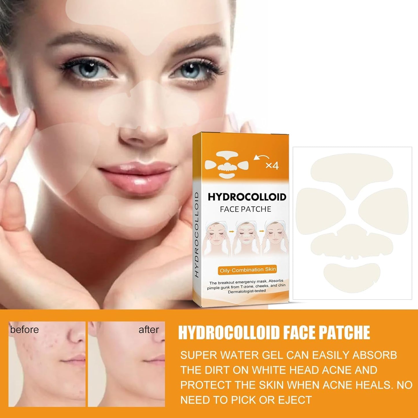 40Pcs Hydrocolloid Acne Patches Full-Face