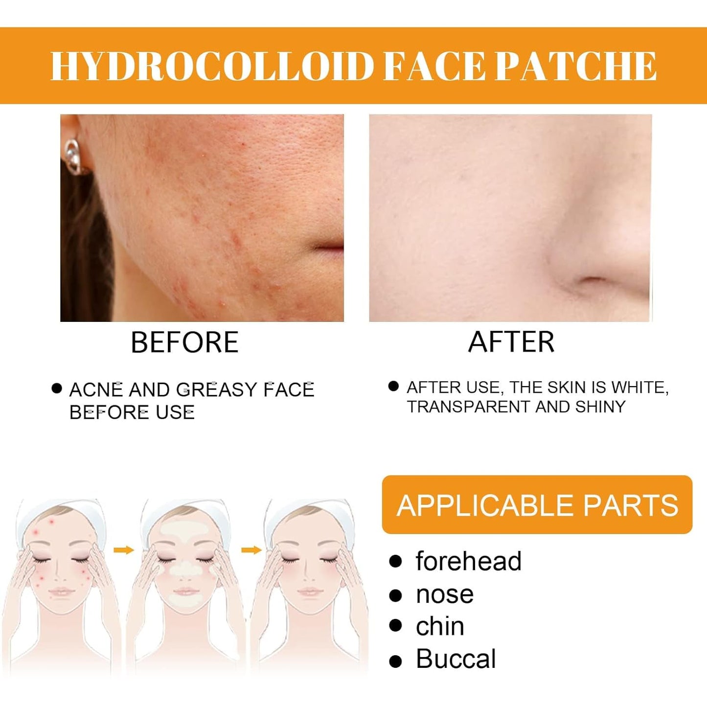 40Pcs Hydrocolloid Acne Patches Full-Face