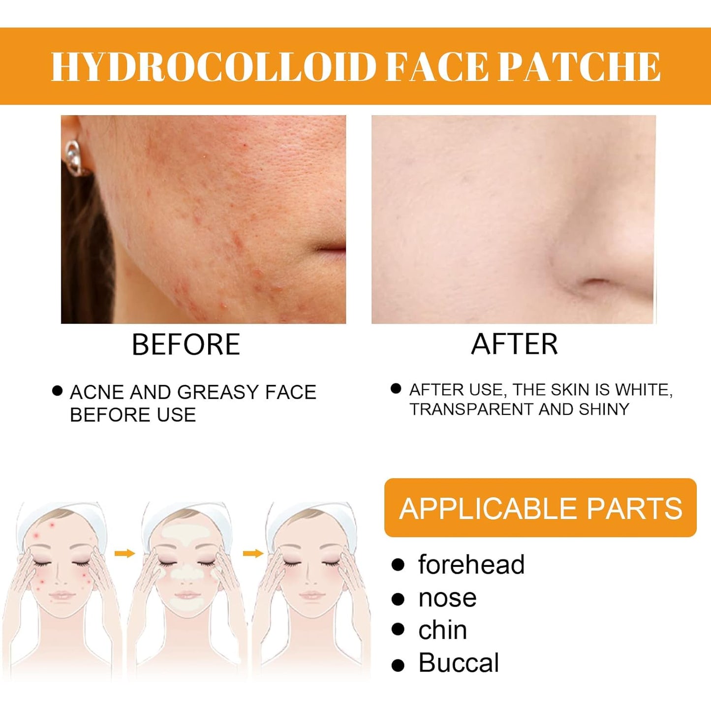 20PCS Hydrocolloid Acne Clearing Patches